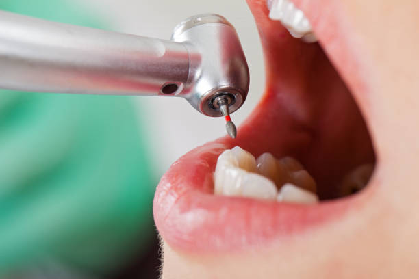 Best Emergency Denture Repair in West Salem, WI